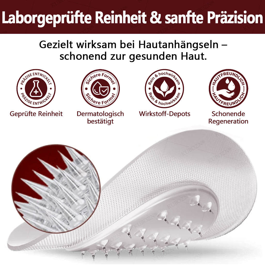 KUBOZN® OryzaDarts TAG’GONE – Schmerzfreie Entfernung an der Wurzel dank Schwarzer-Reis-Mikrotechnologie ✨
