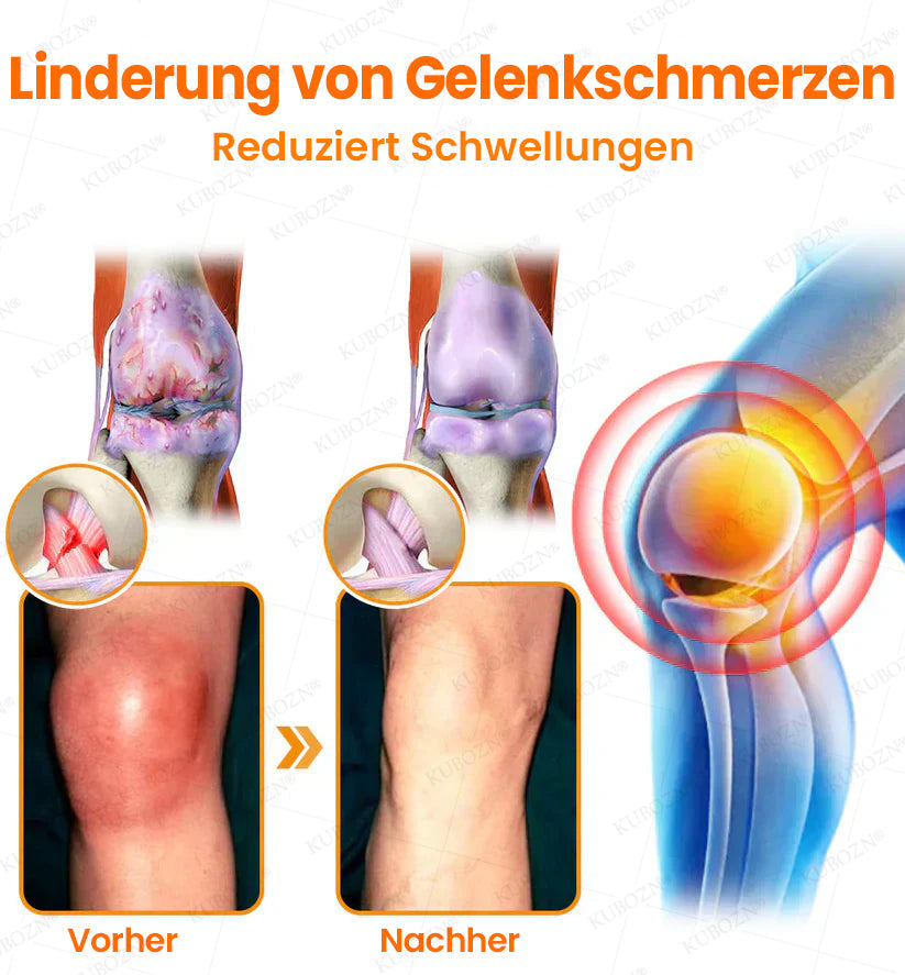 🇩🇪🛡️ KUBOZN® MagniVen Gelenk-Spray – Schnell. Beweglich. Spürbar.