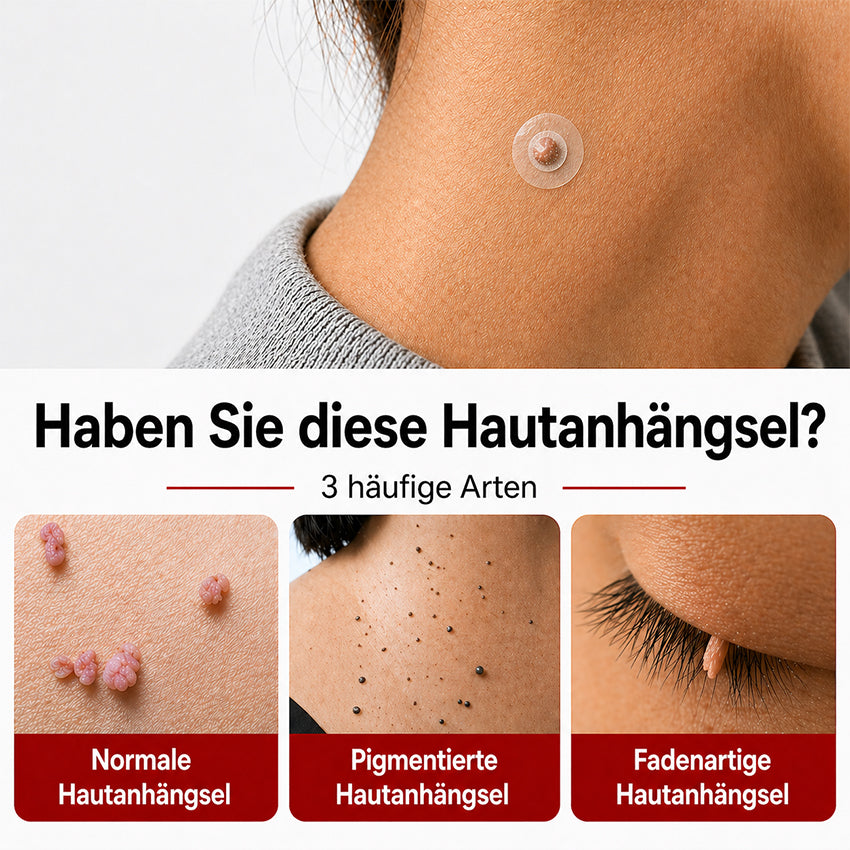 KUBOZN® Pro MicroDarts TAG'Gone Hautpflaster zur Skin-Tag-Entfernung  🅱︎