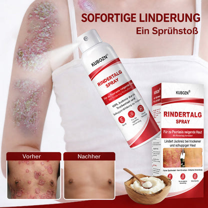 KUBOZN® Rindertalg-Spray für juckende, schuppige Psoriasis-Haut