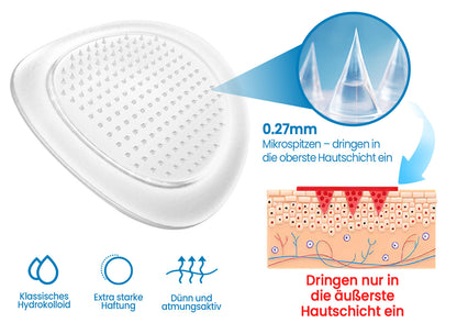 🧬KUBOZN® Mikronadel-Pflaster gegen Gelenkschmerzen & Entzündungen 🅱︎