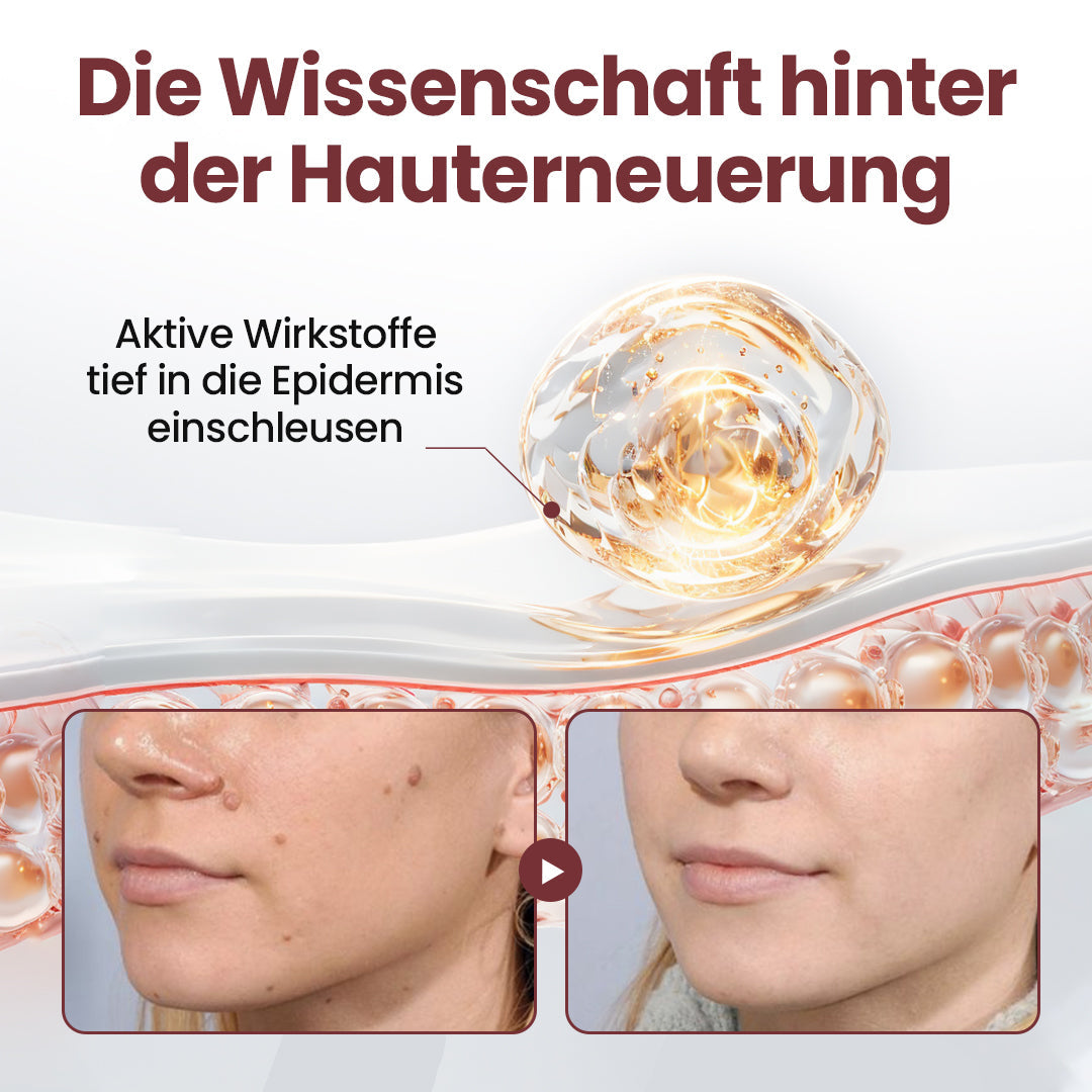 ⭐ KUBOZN® OryzaClear – Schwarzreis-Extrakt Creme gegen Hautanhänge & raue Stellen – sanft, pflanzlich & sichtbar wirksam  🅱︎