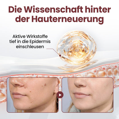 ⭐ KUBOZN® OryzaClear – Schwarzreis-Extrakt Creme gegen Hautanhänge & raue Stellen – sanft, pflanzlich & sichtbar wirksam  🅱︎