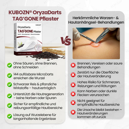 KUBOZN® OryzaDarts TAG’GONE – Schmerzfreie Entfernung an der Wurzel dank Schwarzer-Reis-Mikrotechnologie ✨ 🅱︎