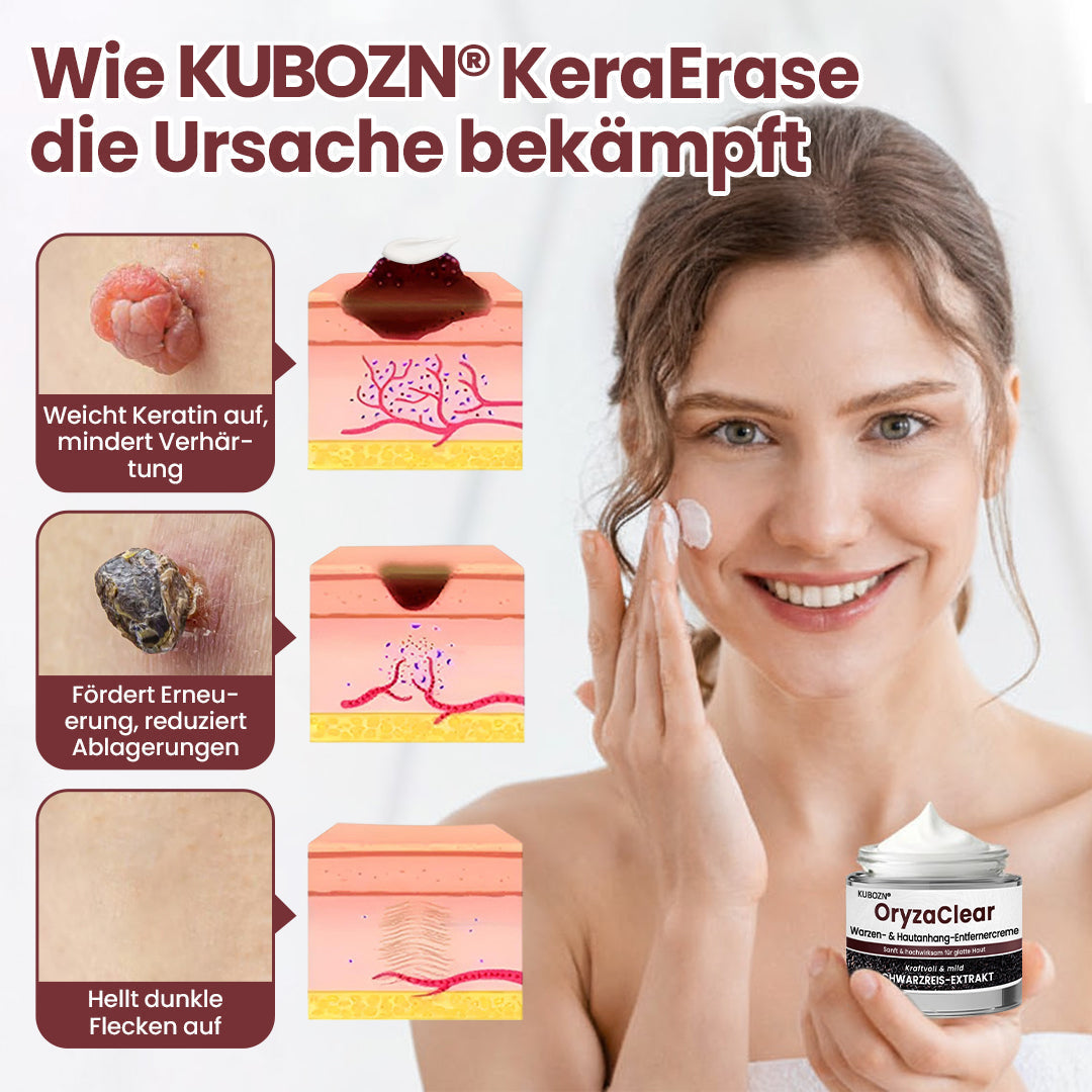 ⭐ KUBOZN® OryzaClear – Schwarzreis-Extrakt Creme gegen Hautanhänge & raue Stellen – sanft, pflanzlich & sichtbar wirksam  🅱︎