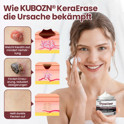 ⭐ KUBOZN® OryzaClear – Schwarzreis-Extrakt Creme gegen Hautanhänge & raue Stellen – sanft, pflanzlich & sichtbar wirksam  🅱︎