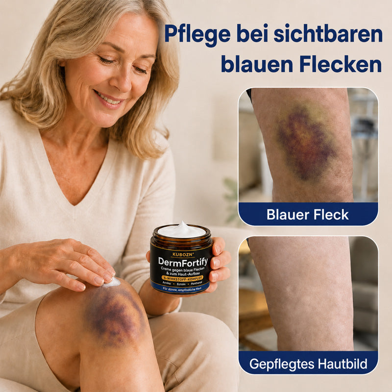 Kubozn® DermFortify – Spezial-Creme gegen blaue Flecken & zum Haut-Aufbau bei dünner, empfindlicher Haut