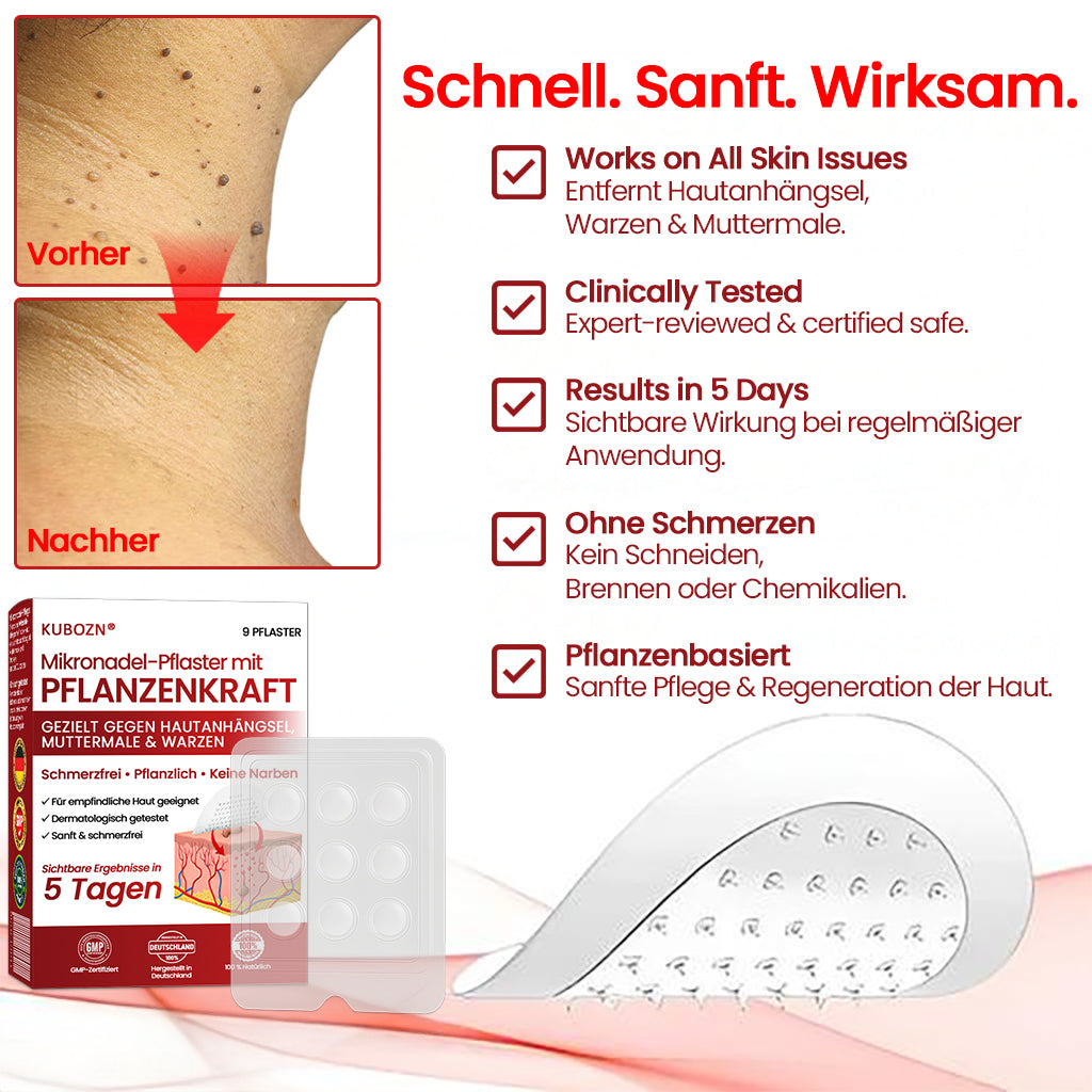 🔥 KUBOZN® Mikronadel-Pflaster – 2025 optimierte Formel gegen Hautanhängsel & Warzen