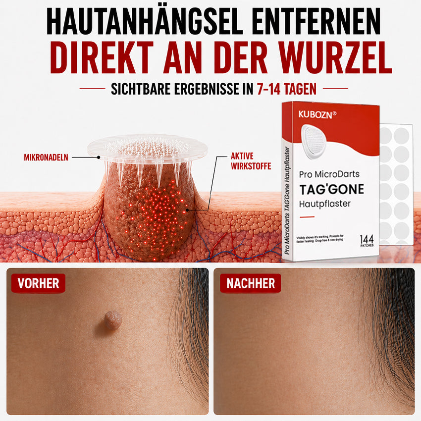 KUBOZN® Pro MicroDarts TAG'Gone Hautpflaster zur Skin-Tag-Entfernung  🅱︎