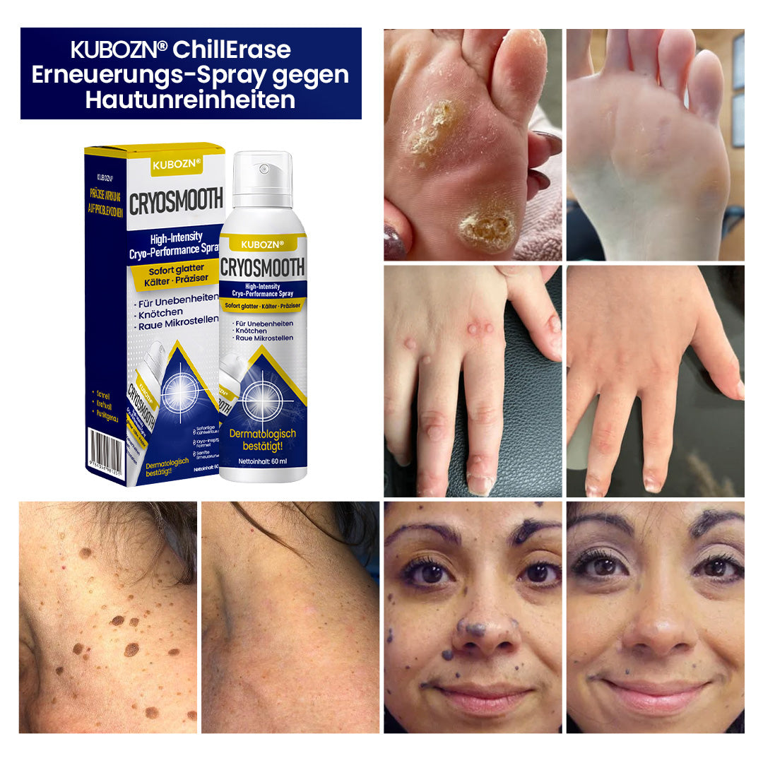 ⭐ KUBOZN® ChillErase – Präzisions-Pflegespray gegen Unebenheiten & kleine Hautknötchen 🅱︎