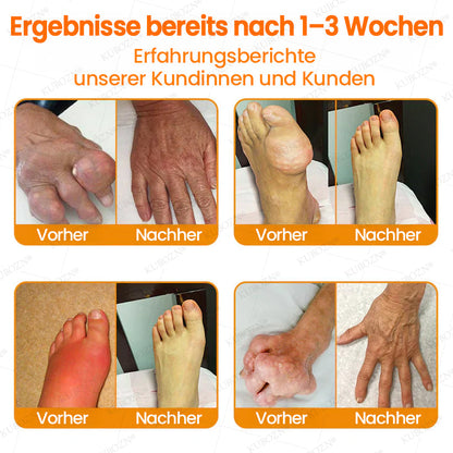 🇩🇪🛡️ KUBOZN® MagniVen Gelenk-Spray – Schnell. Beweglich. Spürbar.