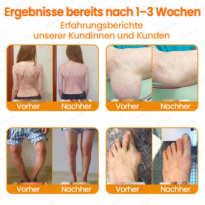 🇩🇪🛡️ KUBOZN® MagniVen Gelenk-Spray – Schnell. Beweglich. Spürbar.