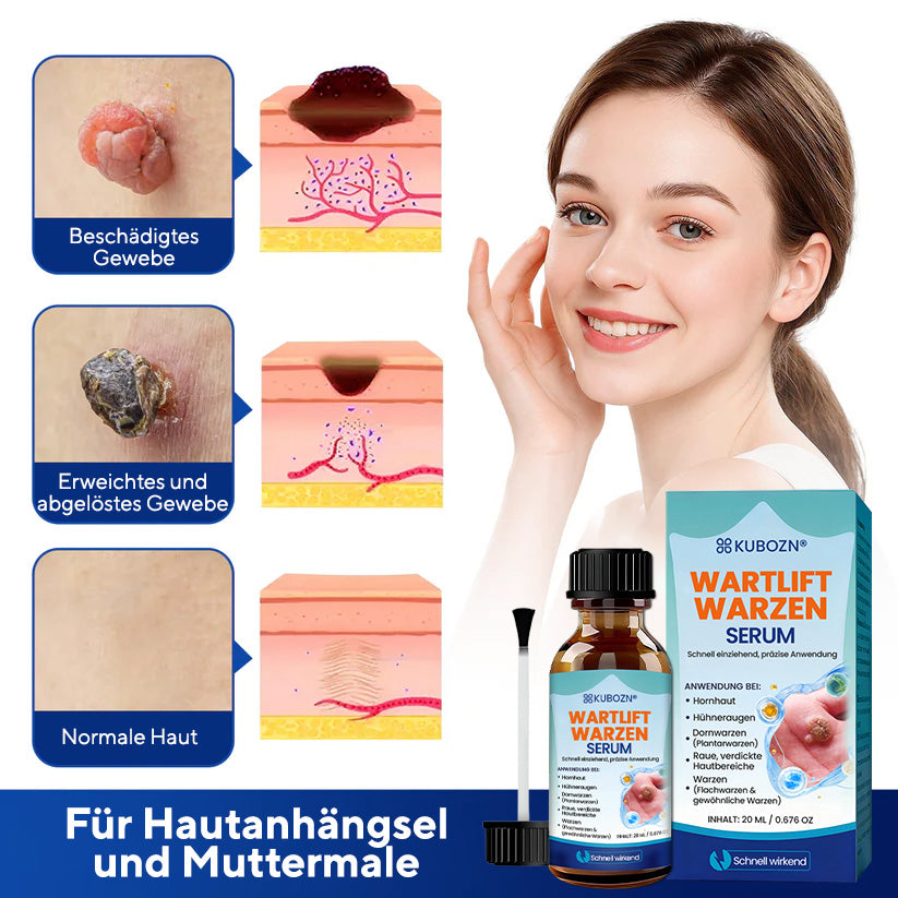 KUBOZN® WartLift Flüssigkeit zur Entfernung von Hühneraugen 🅱︎
