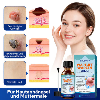 KUBOZN® WartLift Flüssigkeit zur Entfernung von Hühneraugen 🅱︎