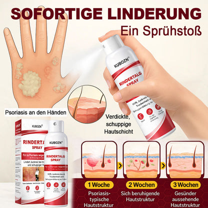 KUBOZN® Rindertalg-Spray für juckende, schuppige Psoriasis-Haut
