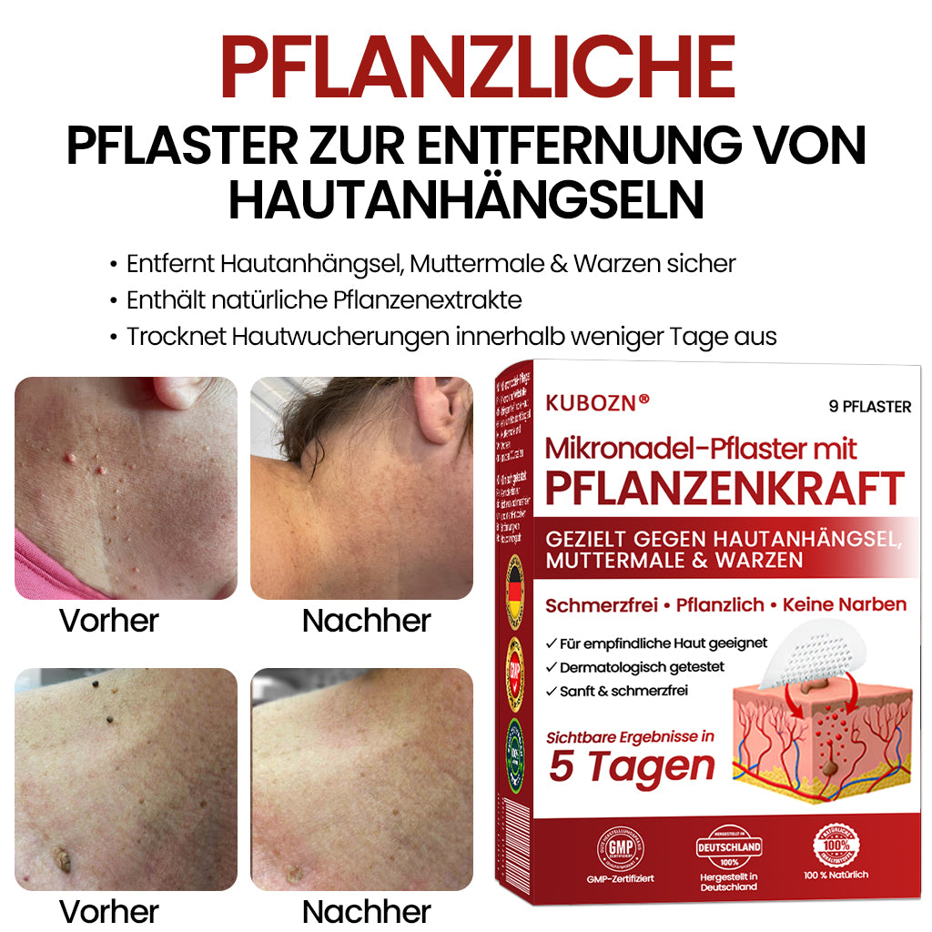 🔥 KUBOZN® Mikronadel-Pflaster – 2025 optimierte Formel gegen Hautanhängsel & Warzen