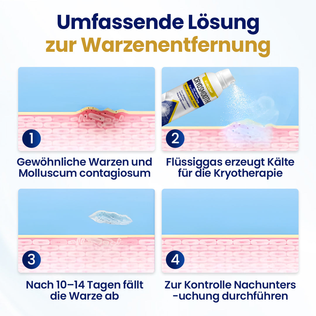 ⭐ KUBOZN® ChillErase – Präzisions-Pflegespray gegen Unebenheiten & kleine Hautknötchen 🅱︎