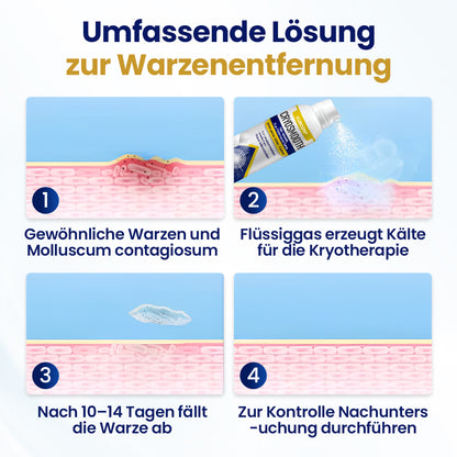 ⭐ KUBOZN® ChillErase – Präzisions-Pflegespray gegen Unebenheiten & kleine Hautknötchen 🅱︎