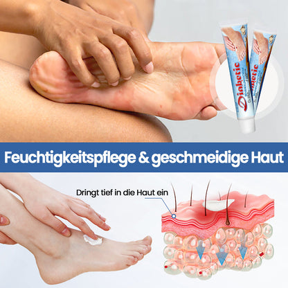 KUBOZN® VitaGluco Diabetes-Behandlungssalbe🌿 Dermatologisch getestet & empfohlen (offer)