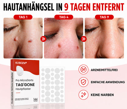 KUBOZN® Pro MicroDarts TAG'Gone Hautpflaster zur Skin-Tag-Entfernung  🅱︎