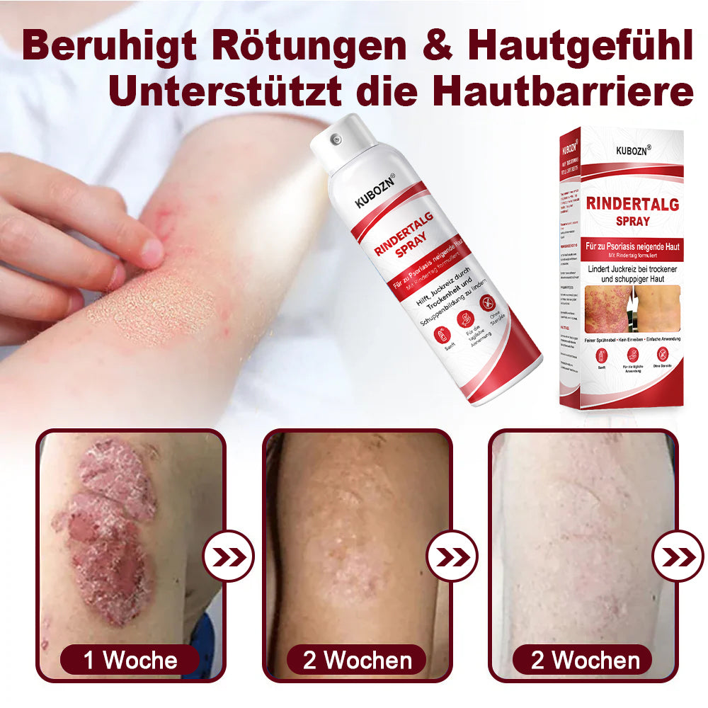 KUBOZN® Rindertalg-Spray für juckende, schuppige Psoriasis-Haut