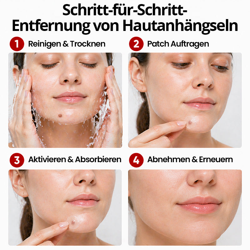 KUBOZN® Pro MicroDarts TAG'Gone Hautpflaster zur Skin-Tag-Entfernung  🅱︎