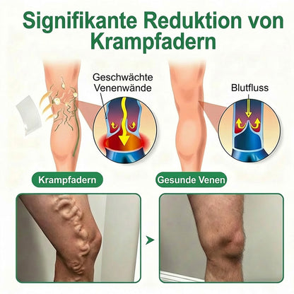 👨‍⚕️🔥Healrize® VeinEase Mikronadel-Technologie⚡Spürbare Wirkung in Tagen – nachhaltige Verbesserung