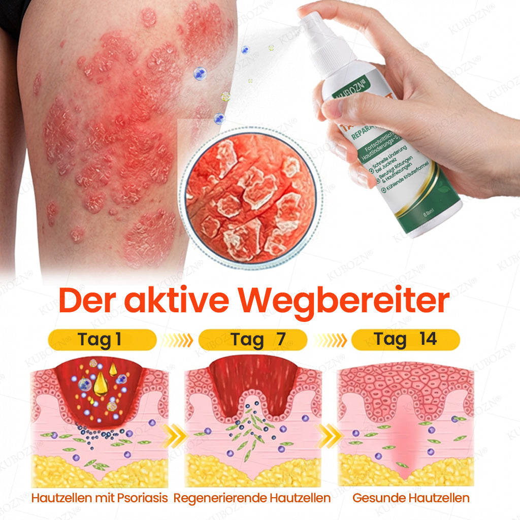 KUBOZN® Psoriasis Tag & Nacht System – 100% steroidfrei gegen Schuppen & Plaque