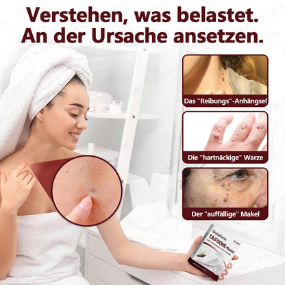 KUBOZN® OryzaDarts TAG’GONE – Schmerzfreie Entfernung an der Wurzel dank Schwarzer-Reis-Mikrotechnologie ✨