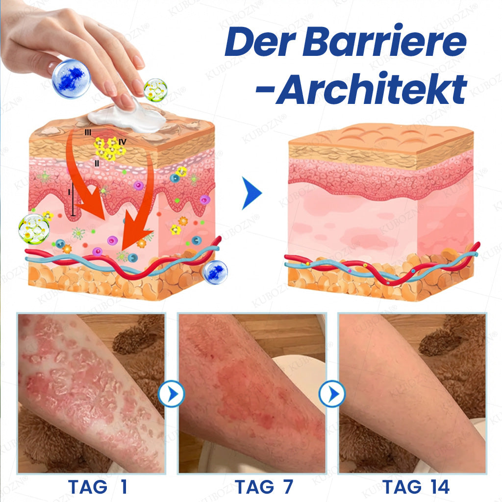 KUBOZN® Psoriasis Tag & Nacht System – 100% steroidfrei gegen Schuppen & Plaque