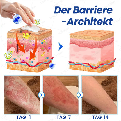 KUBOZN® Psoriasis Tag & Nacht System – 100% steroidfrei gegen Schuppen & Plaque