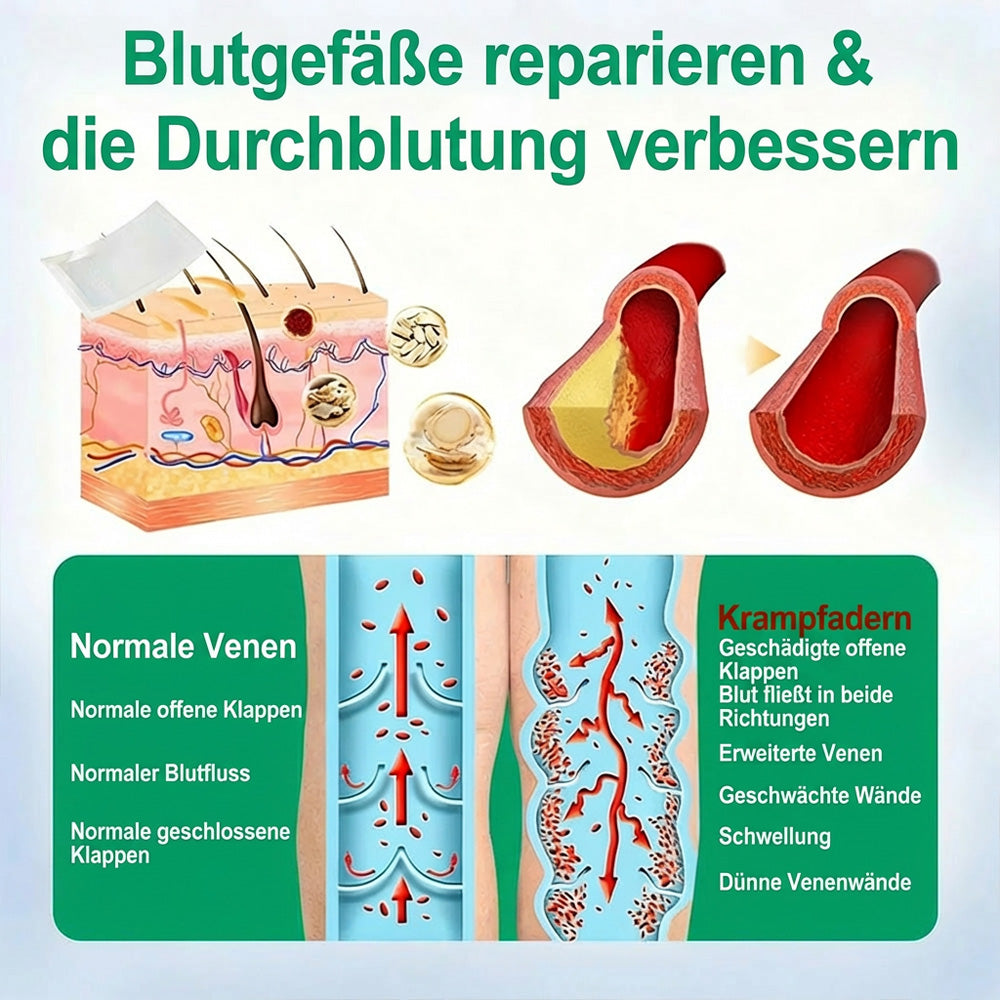 👨‍⚕️🔥Healrize® VeinEase Mikronadel-Technologie⚡Spürbare Wirkung in Tagen – nachhaltige Verbesserung