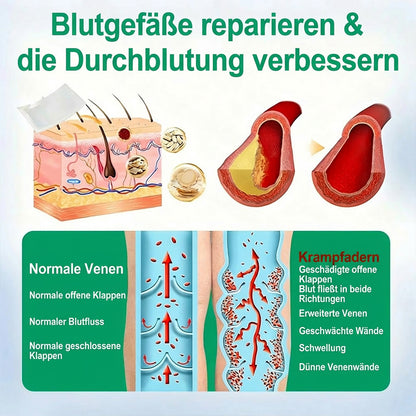 👨‍⚕️🔥Healrize® VeinEase Mikronadel-Technologie⚡Spürbare Wirkung in Tagen – nachhaltige Verbesserung
