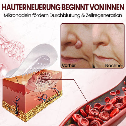 KUBOZN® OryzaDarts TAG’GONE – Schmerzfreie Entfernung an der Wurzel dank Schwarzer-Reis-Mikrotechnologie ✨ 🅱︎