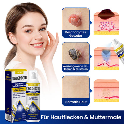 ⭐ KUBOZN® ChillErase – Präzisions-Pflegespray gegen Unebenheiten & kleine Hautknötchen (OFFER)