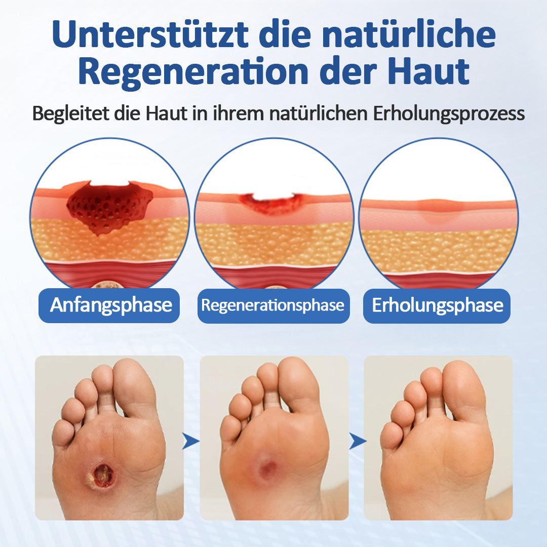 Healrize® GlucoDerm Barriere-Spray