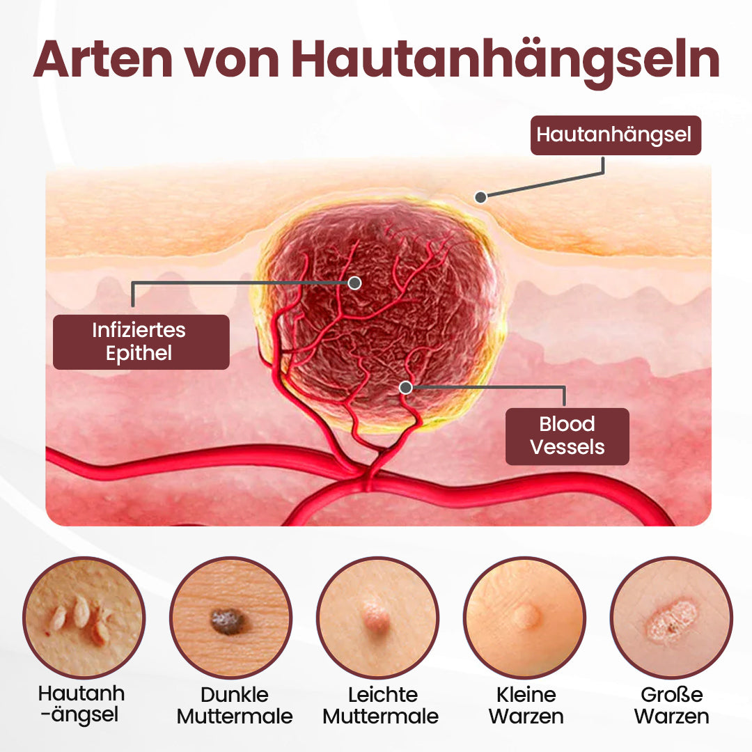 ⭐ KUBOZN® OryzaClear – Schwarzreis-Extrakt Creme gegen Hautanhänge & raue Stellen – sanft, pflanzlich & sichtbar wirksam  🅱︎