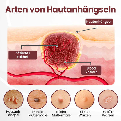 ⭐ KUBOZN® OryzaClear – Schwarzreis-Extrakt Creme gegen Hautanhänge & raue Stellen – sanft, pflanzlich & sichtbar wirksam  🅱︎