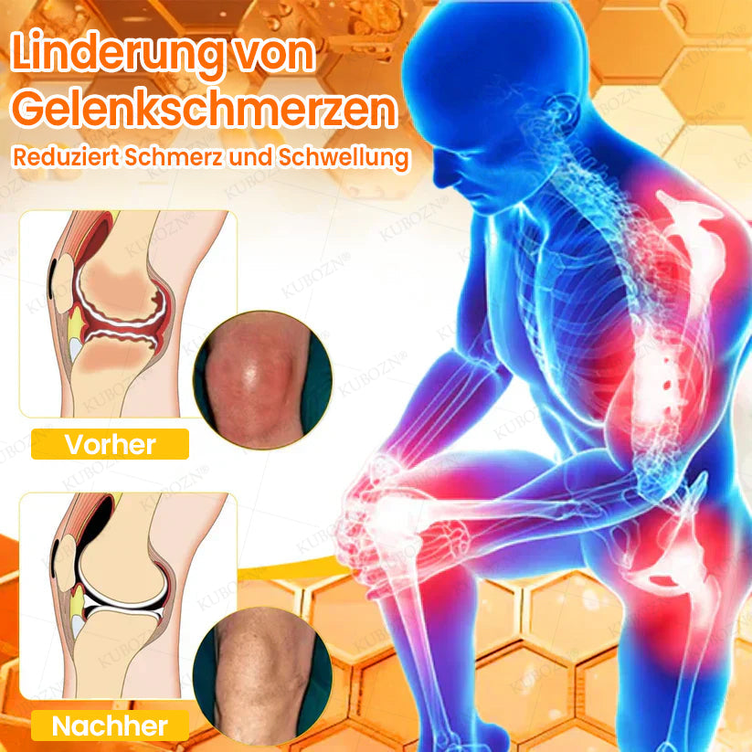 🇩🇪🛡️ KUBOZN® MagniVen Gelenk-Spray – Schnell. Beweglich. Spürbar.