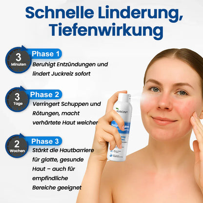 ✅KUBOZN® Neuro-Calm Anti-Juckreiz Akut-Spray – 3-Minuten-Ruhe bei Juckreiz