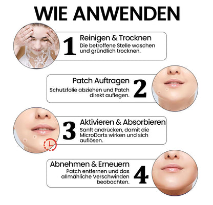 KUBOZN® Pro MicroDarts TAG'Gone Hautpflaster zur Skin-Tag-Entfernung  🅱︎