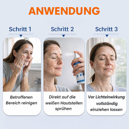 ⚡KUBOZN® Piperin-Repigment-Aktivator-Spray zur Reaktivierung ruhender Pigmentzellen und zur Wiederherstellung der natürlichen Hautfarbe
